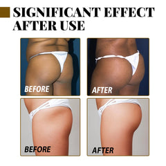 Essential Oil for Lifting and Firming Buttocks
